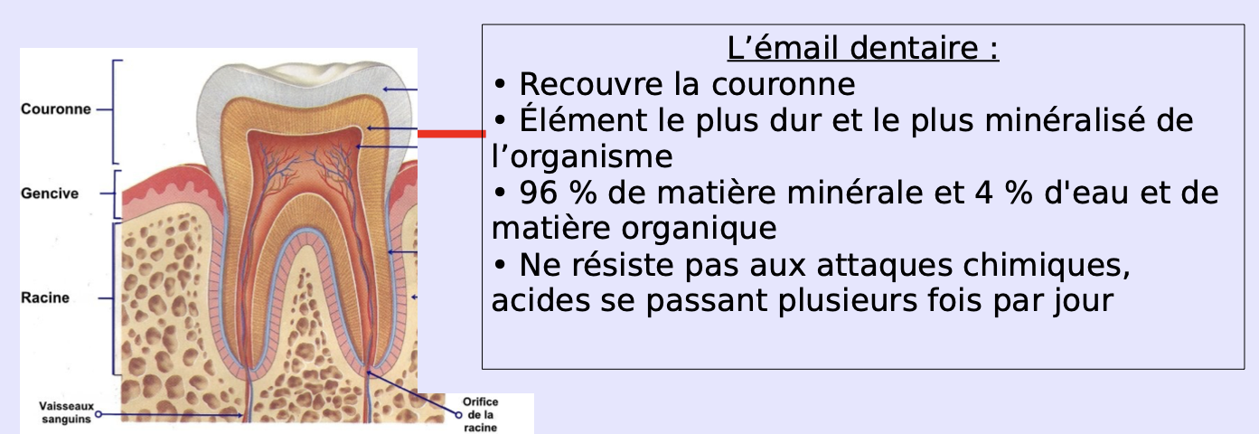 Poster de simulation de caries dentaires